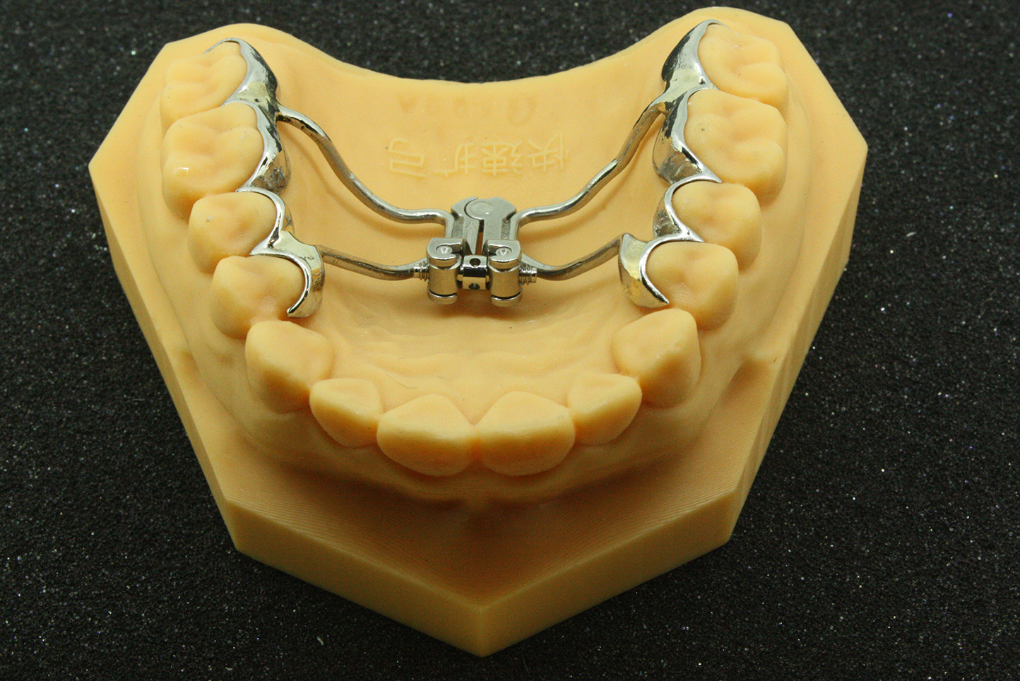 隐形牙齿矫正器和传统牙套 你选哪个 - 贝色口腔